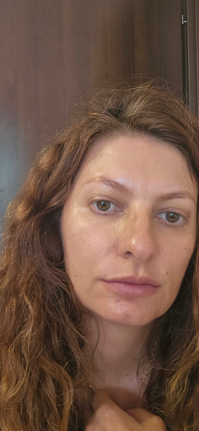 Customer photo review of Esență anti-aging cu complex peptidic Medi-Peel Peptide 9 Volume Essence 100ml
