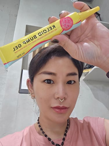 Customer photo review of Piercing Bump & Keloid Treatment Oil Wholesale
