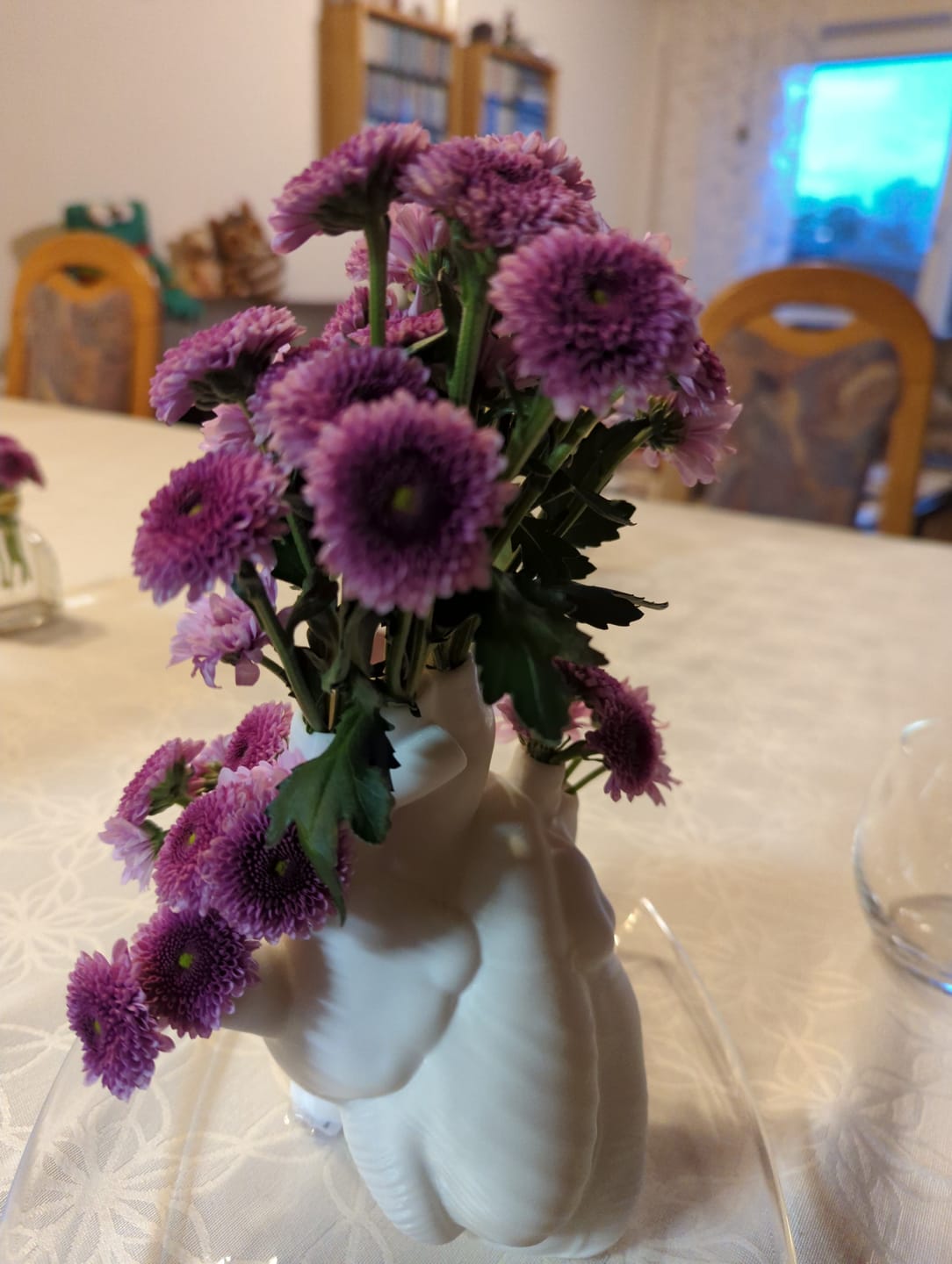 Customer photo review of Dekogefäß - Anatomisches Herz Vase