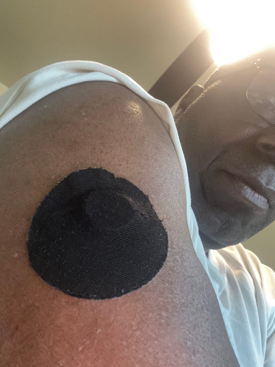Customer photo review of Skin Grip Original - Dexcom G7 & Stelo Adhesive Patches
