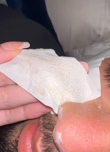 Customer photo review of Deep Pore Cleansing & Aftercare