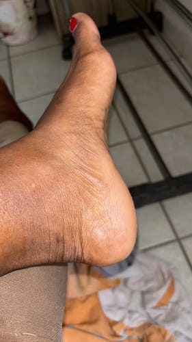 Customer photo review of Gommage solide des pieds