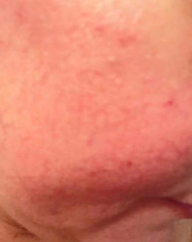 Customer photo review of NIDA Youthful Formula Ultimate Moisturizing Cream.