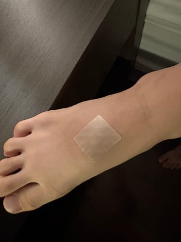 Customer photo review of HAUTUKI Growth Support Patch - 10 Month Supply (10Box) 50% OFF