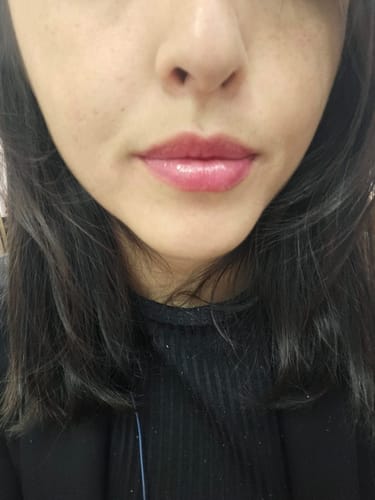 Customer photo review of PEPTIDE LIP BALM