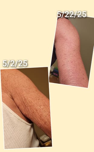 Customer photo review of Besque™ Magic Body Oil - 100ml