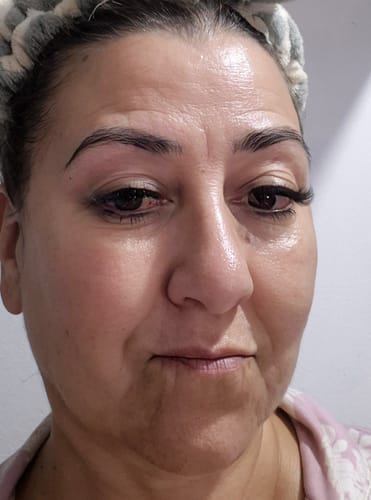 Customer photo review of The Hydration Booster Sheet Mask