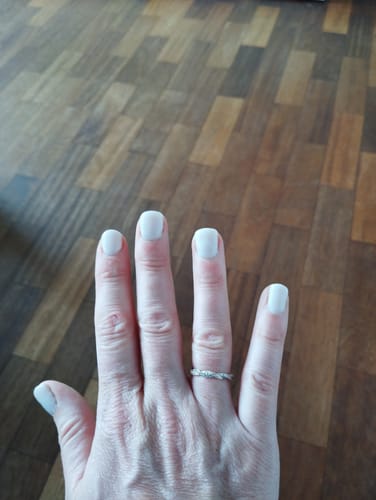 Customer photo review of Glowdip Alles-in-één Manicure Set