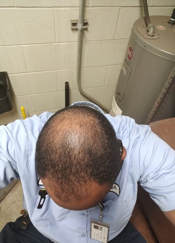 Customer photo review of Rennora Hair Growth Serum