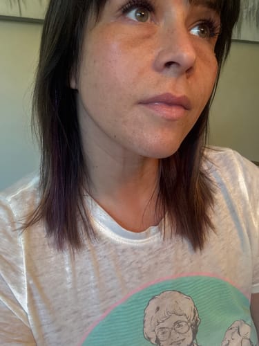 Customer photo review of Neck & Face Firming Kit