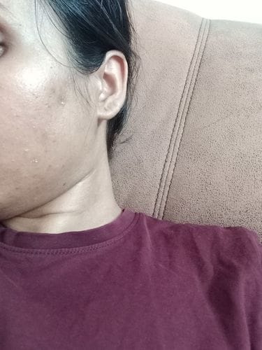 Customer photo review of Night Repair Elixir (Glow)