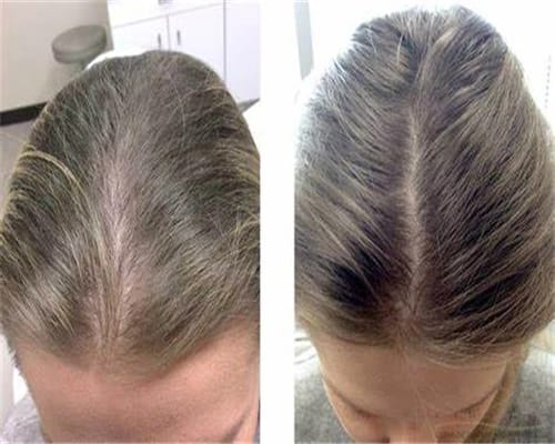 Customer photo review of Chebe Fast Hair Growth Sevich Traction Alopecia Hair Karkar Oil Anti Hair Break Hair Strengthen Hair Loss Care Repair Damage