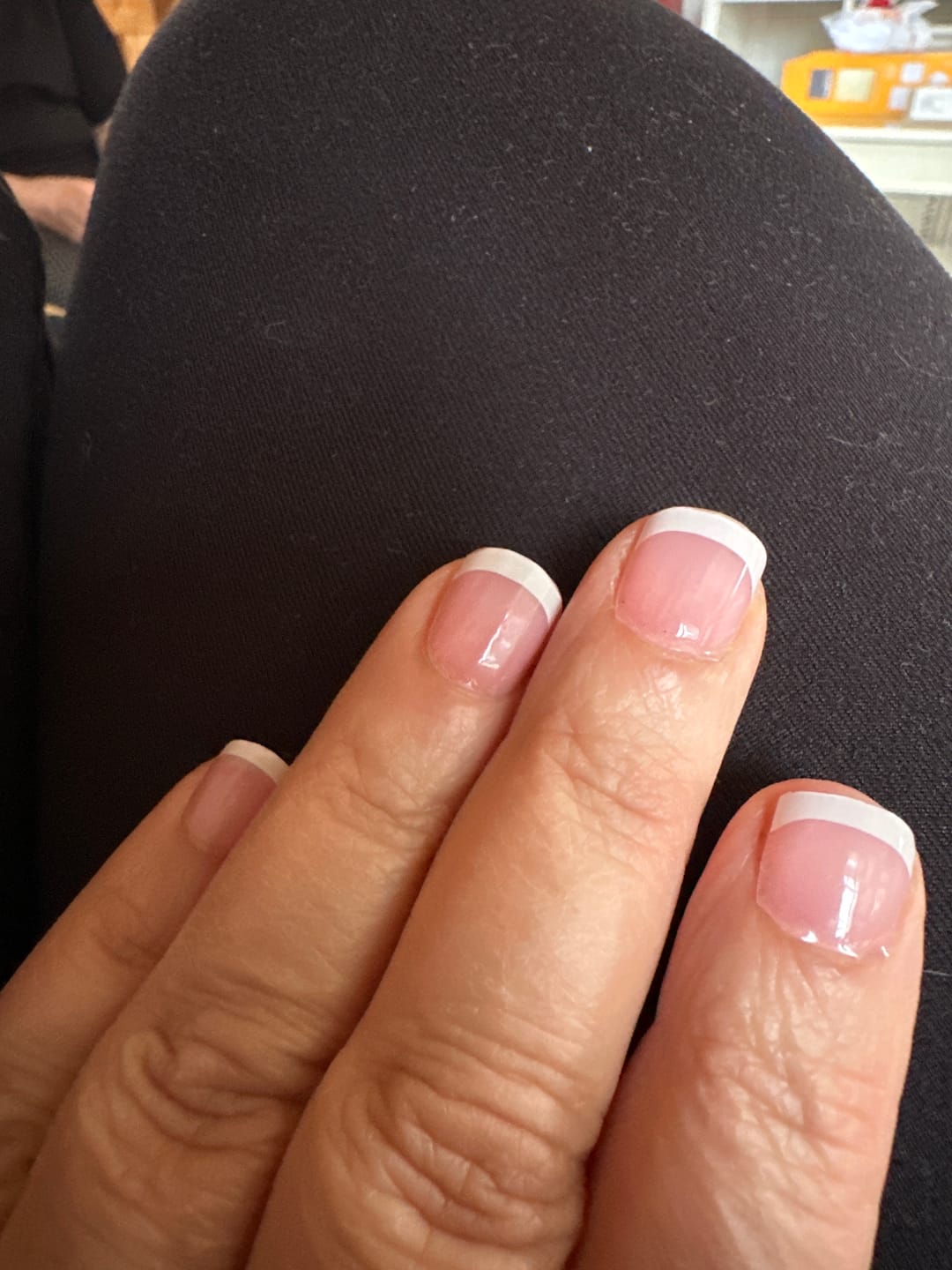 Customer photo review of Ohora Mini Jel Tırnak Soyucu Çıkarıcı 5ml