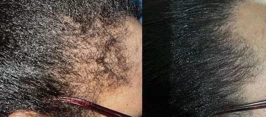 Customer photo review of Chebe Fast Hair Growth Sevich Traction Alopecia Hair Karkar Oil Anti Hair Break Hair Strengthen Hair Loss Care Repair Damage