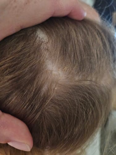Customer photo review of Baby Scalp Oil