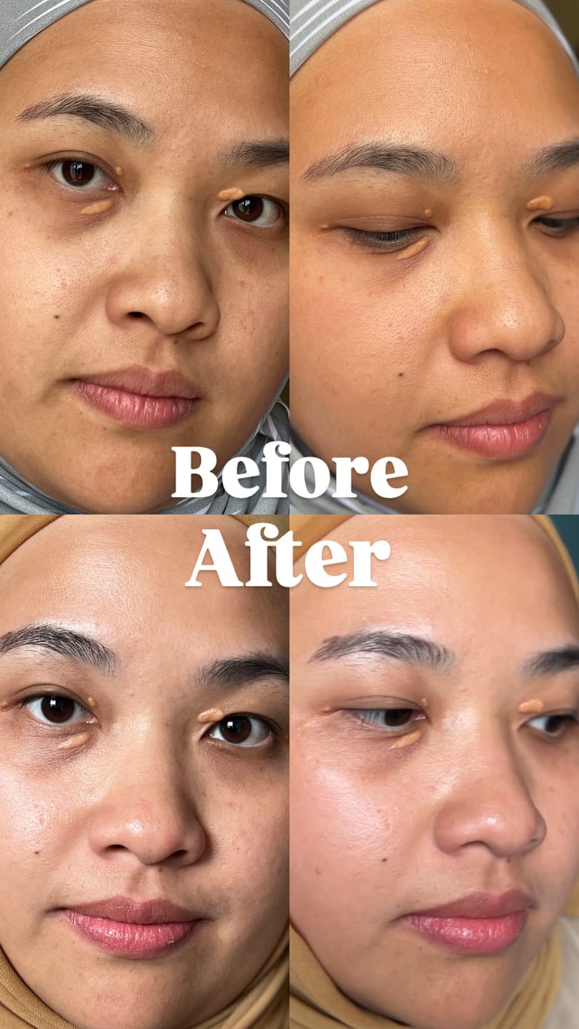 Customer photo review of Gold Radiance Serum