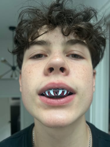 Customer photo review of SHOCK DOCTOR GEL MAX POWER FANG MOUTHGUARD