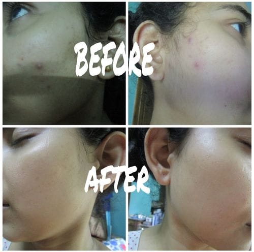 Customer photo review of Night Repair Elixir (Glow)