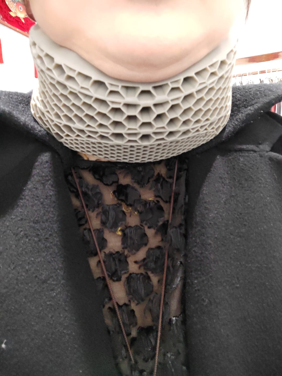 Customer photo review of CervicalEase Neck Support