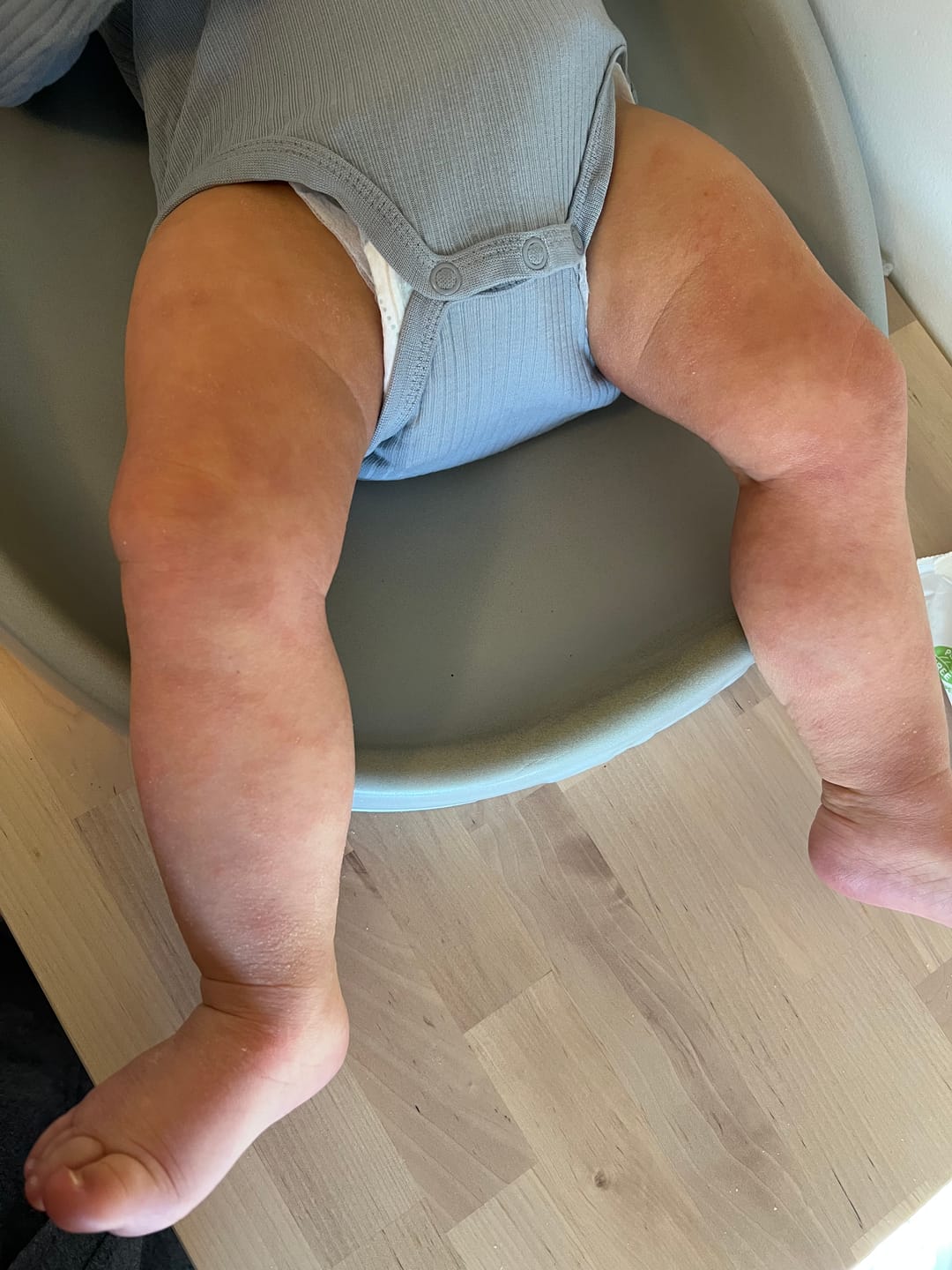 Customer photo review of Children’s Gut Rebalance Kit