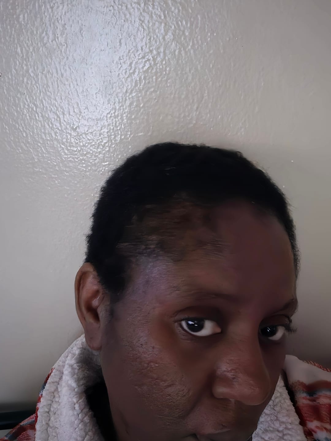 Customer photo review of Rosemary Shampoo & Conditioner Bundle