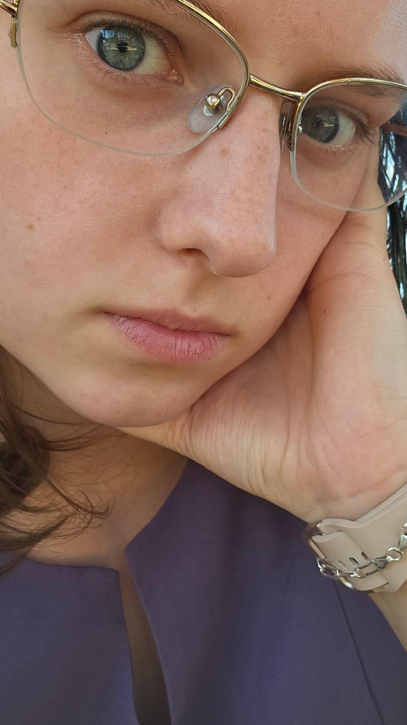 Customer photo review of Eyeling Custom Lens (1 month)