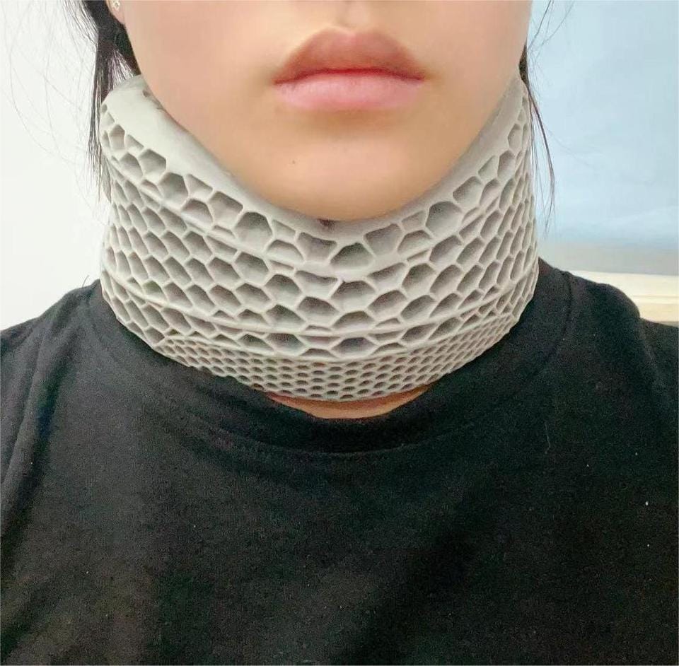 Customer photo review of CervicalEase Neck Support