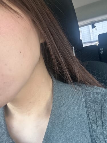 Customer photo review of HA-Lifting 35（ボトックスセラム）2本セット