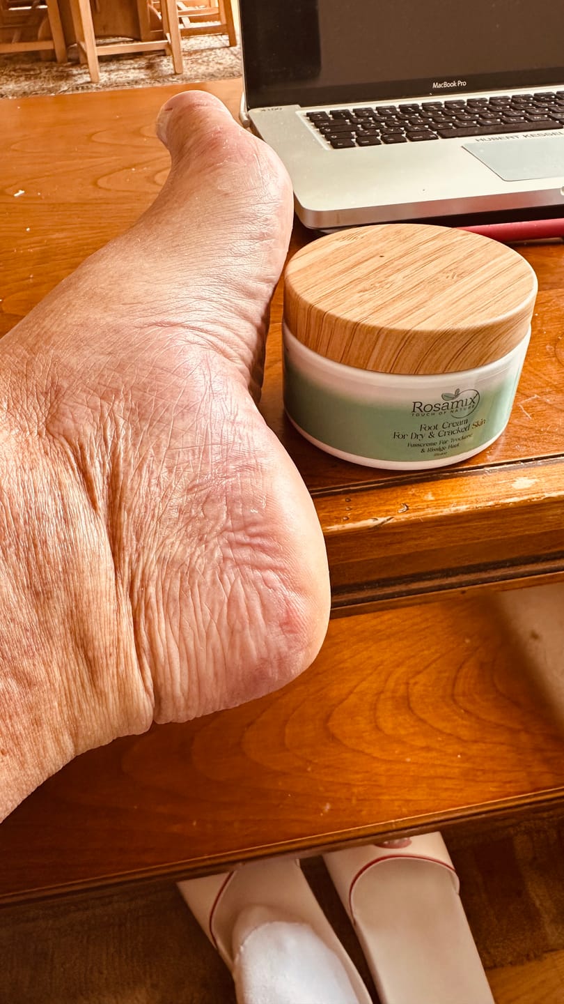 Customer photo review of Fusscreme Für Trockene & Rissige Haut