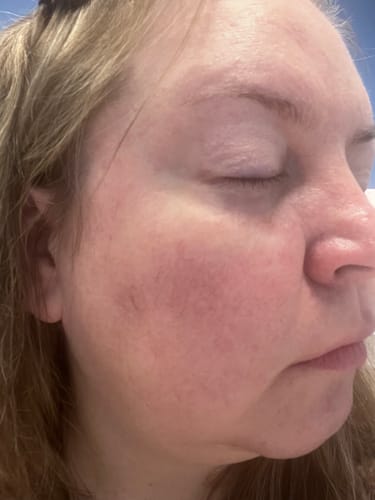 Customer photo review of Shipping Insurance