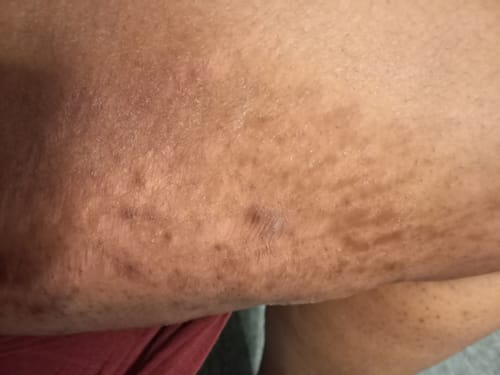 Customer photo review of Peeling savon noir anti vergetures