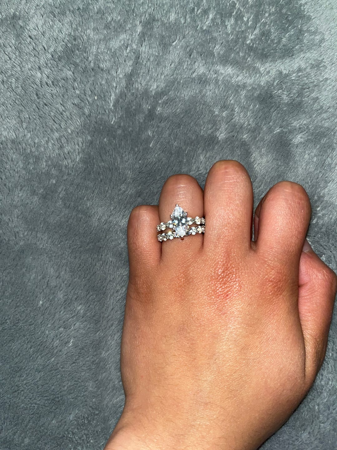 Customer photo review of Royal Ring Set