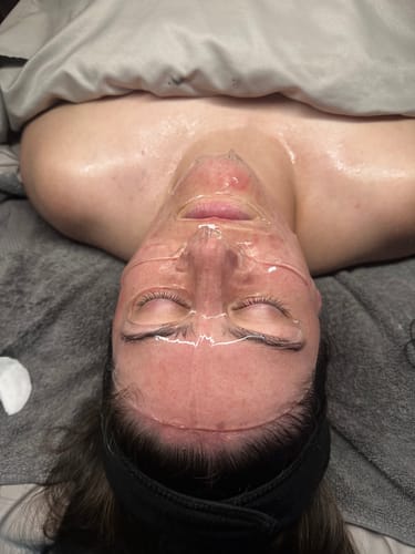 Customer photo review of The CryoPeptide 20 Pack