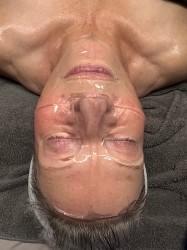 Customer photo review of The CryoPeptide 20 Pack