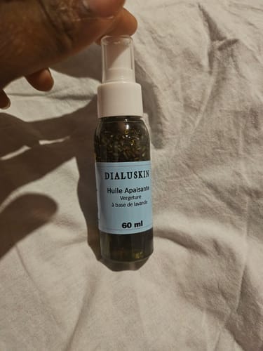 Customer photo review of Huile de vergetures apaisante à base de lavande