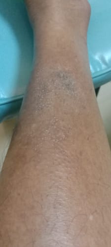 Customer photo review of Jolicare Lotion