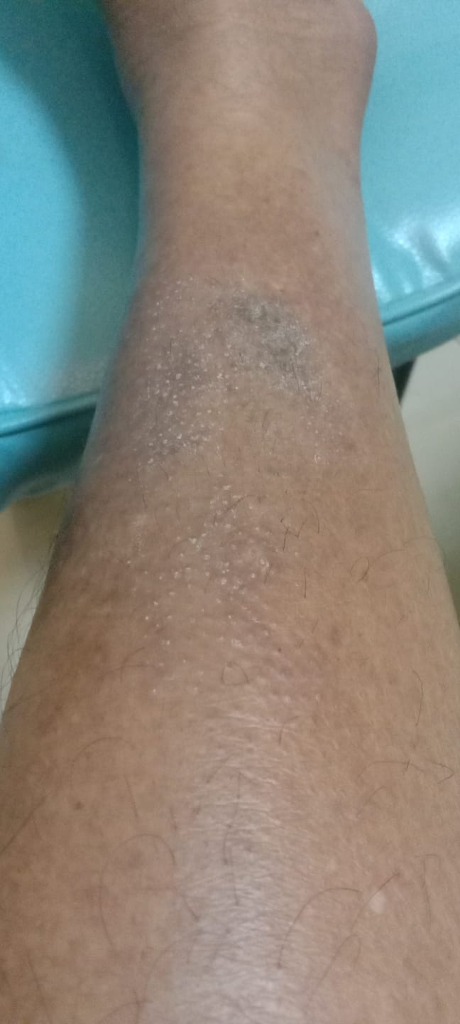 Customer photo review of Jolicare Lotion
