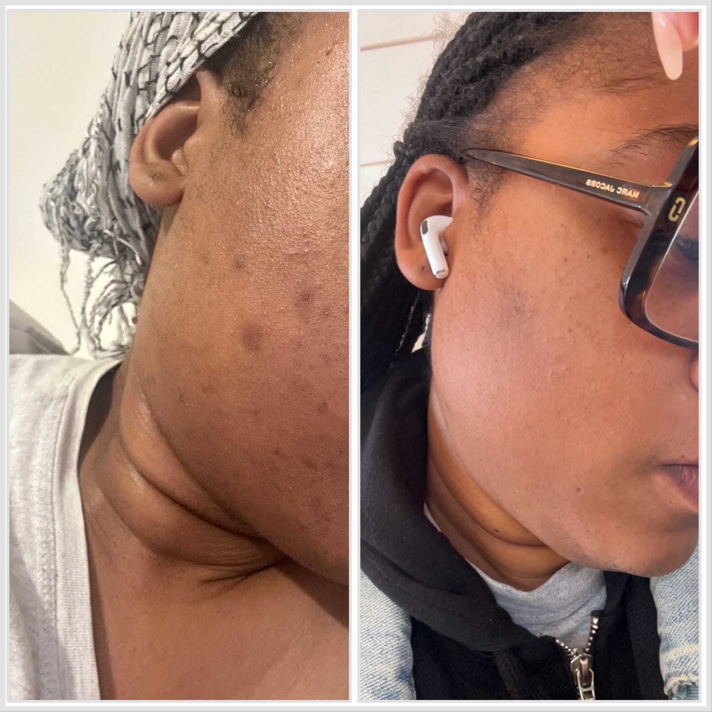Customer photo review of Savon visage biscuit