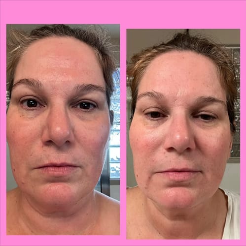 Customer photo review of Lumo⁺ + Venus + Phoenix: Ultimate Trio for Youthful and Radiant Skin