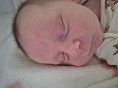Customer photo review of Baby-Soft Balm Stick