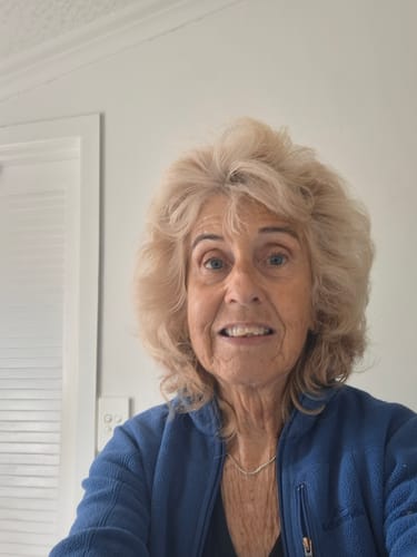 Customer photo review of Dry/ Mature Skin - Arohanui Facial Serum