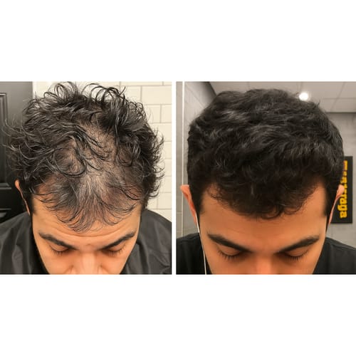 Restore Max The Complete Hair Regrowth Stack Maneup Restore Max The Complete Hair Regrowth Stack Maneup