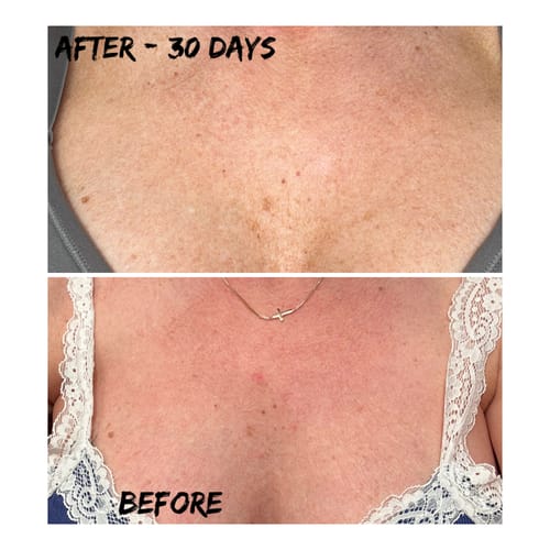 Customer photo review of Besque™ Magic Body Oil - 100ml