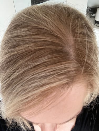 Customer photo review of Sunkissed Starter Kit