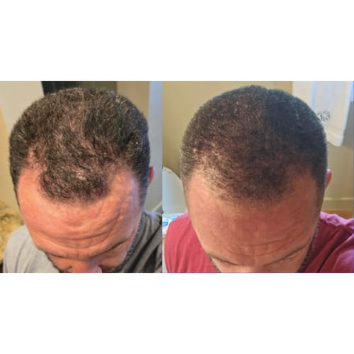 Tyler's progress photo