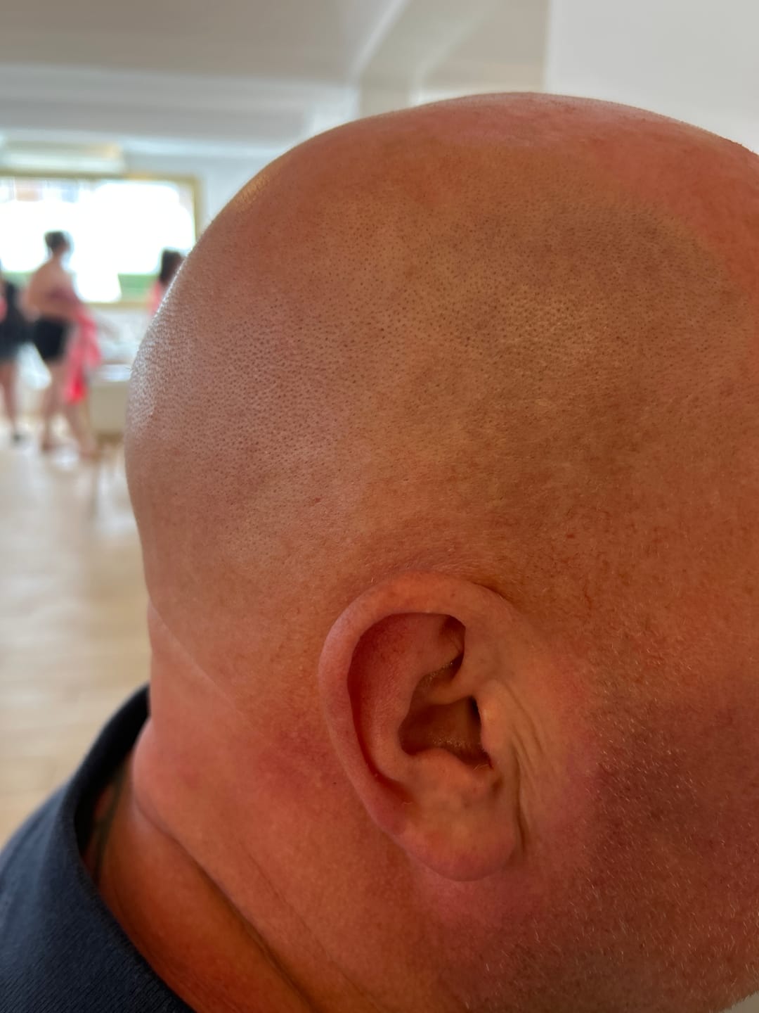 Customer photo review of Trimpod 3.0: The Ultimate Shaver for Bald Men