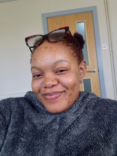 Customer photo review of Turmeric Glow Soap