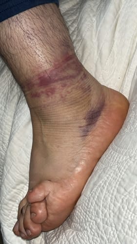 Customer photo review of Organic Pain Free
