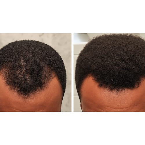 Xavier's progress photo