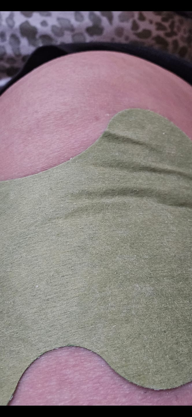 Customer photo review of Auxilium Joint Patches (fka "Heaven Patch")